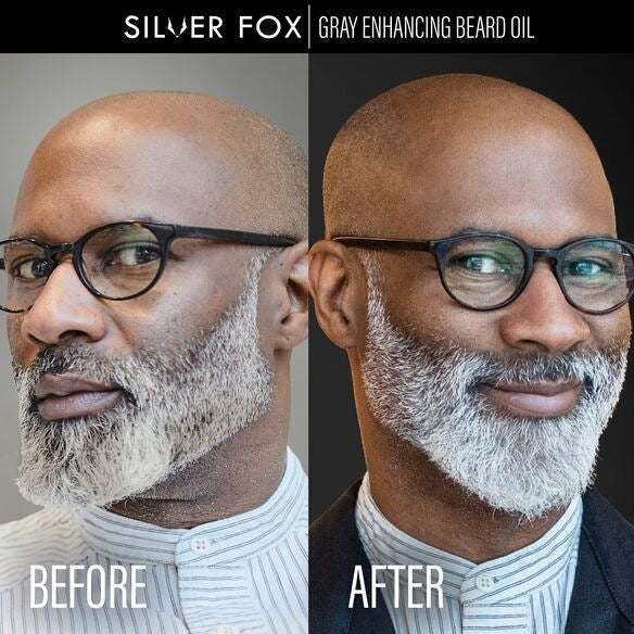 Silver Fox Beard Oil for Gray Hair - Image 3